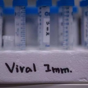 Echantillons tubes vaccins Thomas Luhaka veut renforcer les mesures de prévention du Covid-19 en milieux universitaires