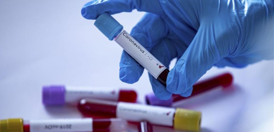 Covid-19 en RDC : aucun protocole local validé