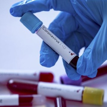 Covid-19 : 78 personnes guéries dont 68 à Kinshasa