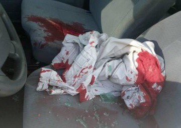 L&rsquo;homme d&rsquo;affaires Simba Ngezayo assassiné à Goma