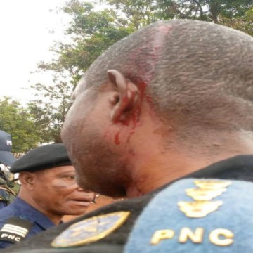 Commandant PNC Beni, blessé