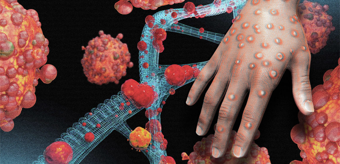 Virus du Monkeypox